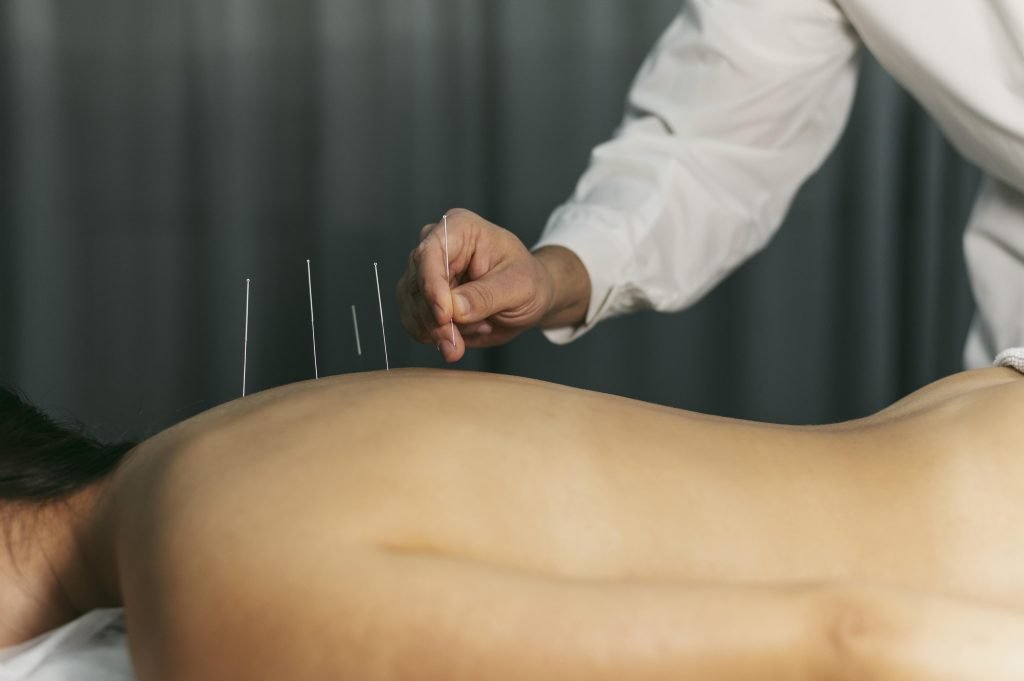 Acupuncturist in Houten